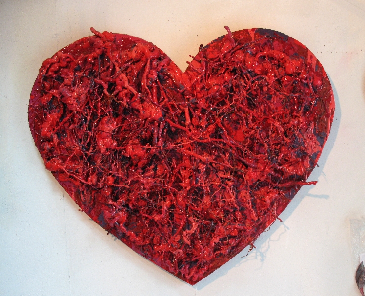 Heart Attack
      Heart